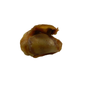 Runderknieschijf